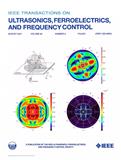IEEE TRANSACTIONS ON ULTRASONICS FERROELECTRICS AND FREQUENC